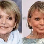 Uschi Glas Schlaganfall